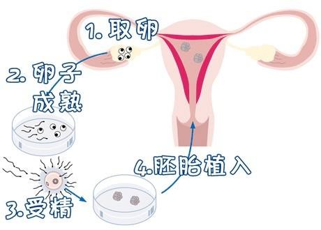 景泰生殖医学中心